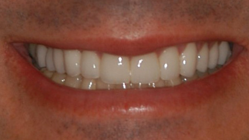 Cosmetic Dentist in Reisterstown